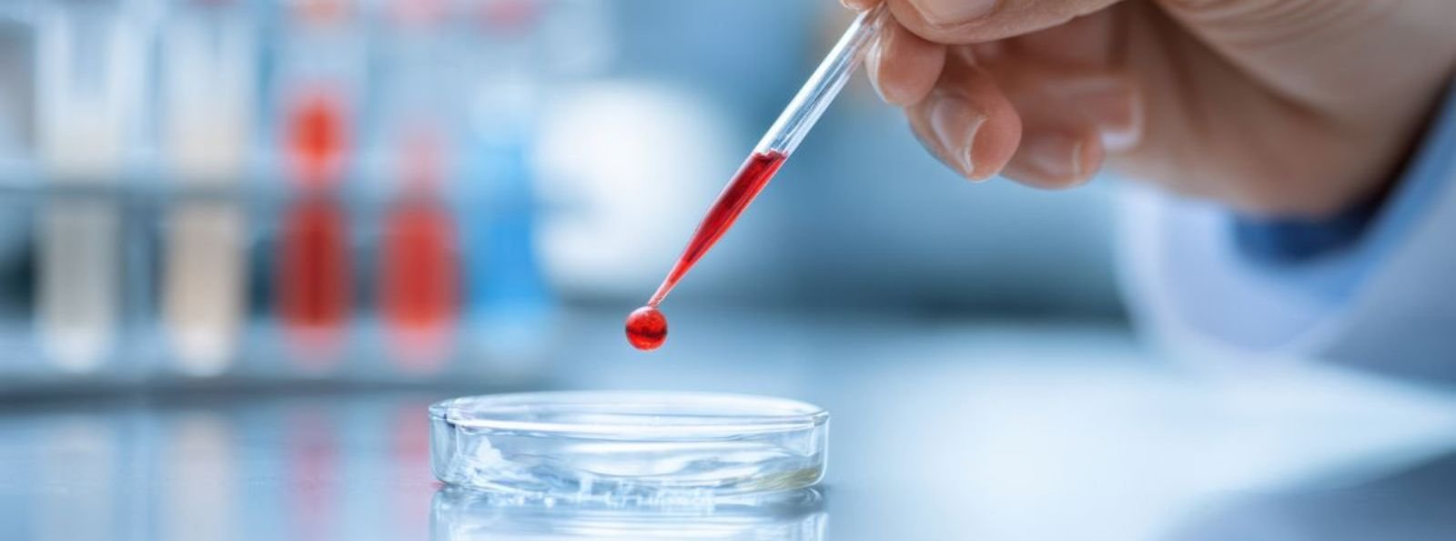 Skuteczność i bezpieczeństwo emicizumabu u pacjentów z ciężką hemofilią A bez inhibitora. Raport z 3-letniej obserwacji Brytyjskiej Organizacji Lekarzy Leczących Chorych na Hemofilię (UKHCDO)